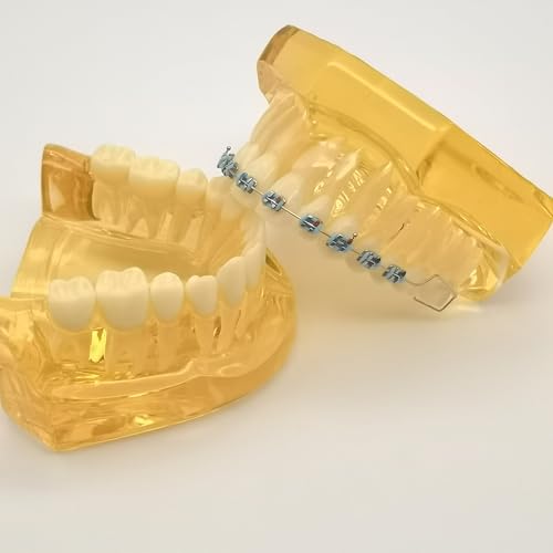 2 Pcs Temporary Tooth Decoration with Metal Wires Bracket Orthodontic Ligature Ties, Fashionable Colorful Fake Braces for Orthodontists Help Patients Understand Their Treatment (Blue)