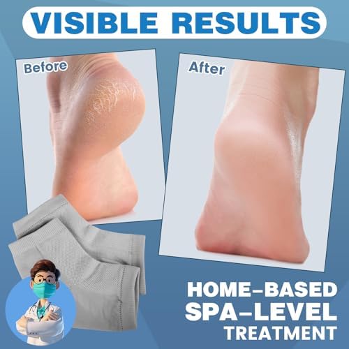 Moisturizing Toeless Socks for Cracked Heels - Heel Repair, Hydrate Dry Feet