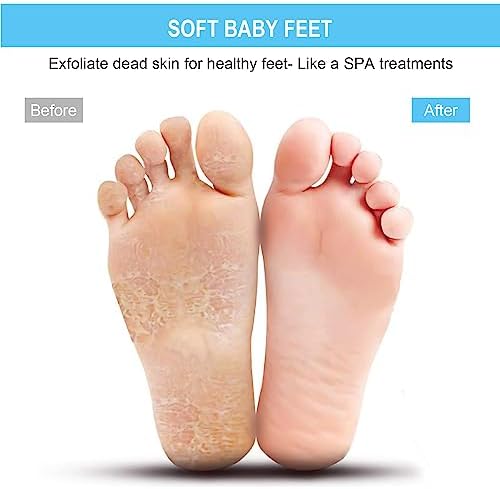 BESKAR Larger Foot Scrubber Mat with Non-Slip Suction Cups- Cleans, Smooths, Exfoliates & Massages Without Bending, Circulation & Soothes Tired Feet, Great for Shower or Bathtub