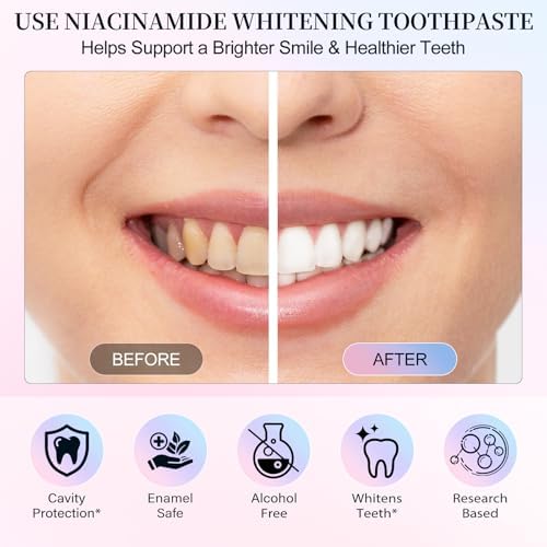2Pack Niacinamide Whitening Toothpaste, Niacinamide Intensive Toothpaste, Fresh Breath, Remove Tooth Stains, 7.6 Oz