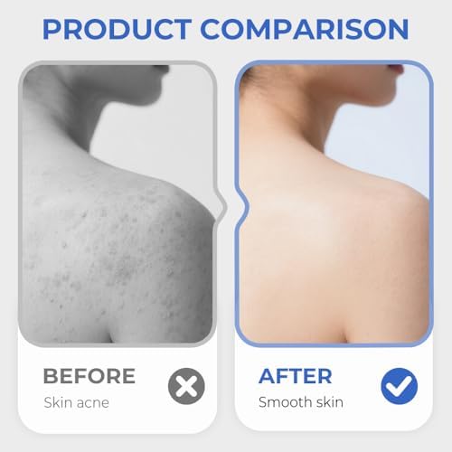 Silicone Shower Foot Scrubber Mat,2025 New Back Exfoliating Bath Wash Pad Wall Mounted Anti-Slip Suction Cups Foot Scrubber,Deep Cleaning Brush Back Massager Pad for Women Men (A-Yellow)