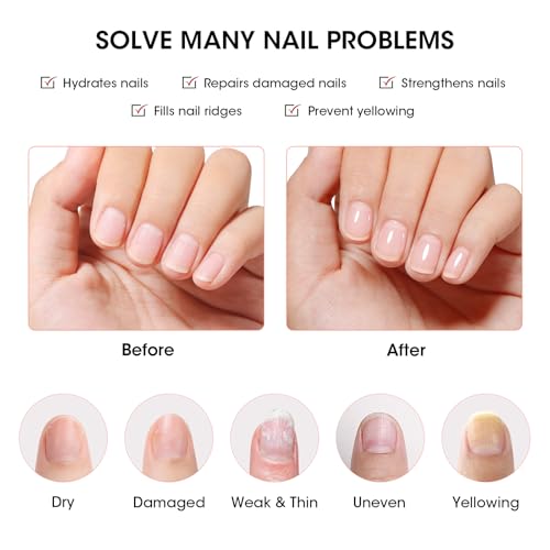 GELLEN Clear Nail Polish Ridge Filling Base Coat, Nail Strengthener Ridge Filler For Nails, Hydrates Strengthens Nourishes Damaged Dry Natural Nails, Shea Butter & Vitamin E & Protein Formula