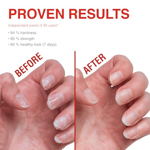 Probelle Nail Strengthener and growth, Natural Nail Strengthening Clear Nail Polish Repair Treatment, Nail Growth & Conditioning, Stops Splits, Chips, Cracks & Strengthens Damaged and Thin Nails