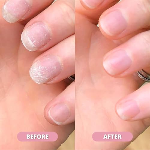 Nailz Nail 𝐆𝐫𝐨𝐰𝐭𝐡 Pen, Radiant Serum Oil Pen, Cuticle Oil for Nails, Nail 𝐍𝐮𝐭𝐫𝐢𝐞𝐧𝐭 Oil Pens for Moisturize Strengthen 𝐁𝐫𝐢𝐠𝐡𝐭𝐞𝐧 Nails Care (4pcs, 2ml)