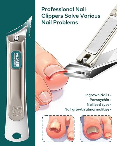 MR.GREEN Ingrown Nail Clippers, Slanted Curved Blade Nail Clippers for Ingrown Nails, Toenail Clippers for Thick Nails, Medical Grade Stainless Steel Professional fingernail Clippers For Men And Women