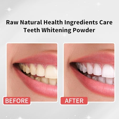 7 Benefits Hydroxyapatite Remineralizing Tooth Powder - Natural Teeth Whitening Powder Toothpaste - 1.76OZ(1 Pack)