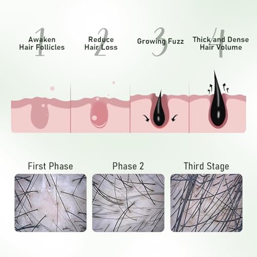 Batana Oil Hair Growth Bundle-100% Pure Natural Rosemary Oil and Hair Growth Shampoo-Natural Hair Treatment for Women & Men –Hair loss & Thicker, Healthier Hair