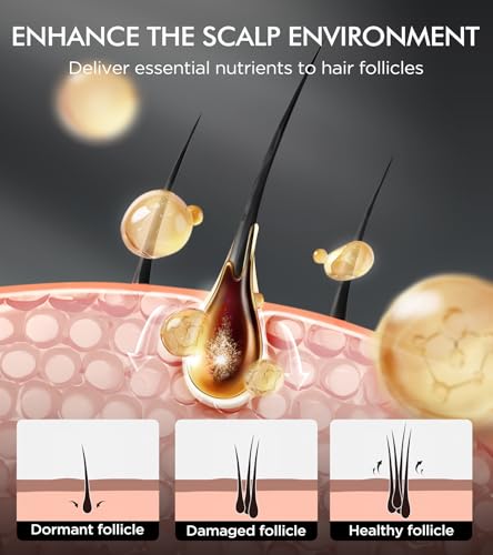 Tripeptide-Infused Hair Growth Biotin Shampoo and Conditioner Set, Onion Anti-Loss Volumizing Moisturizing Treatment for Soft Shine Hair, Rosemary Clarifying Dandruff Shampoo for Women Men, 2 x 16.9oz