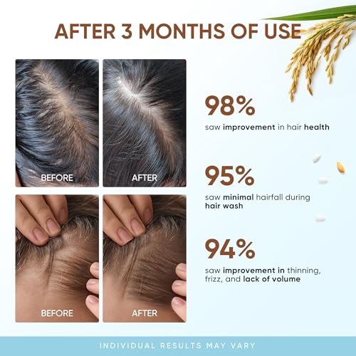 Rice Water Hair Growth Shampoo - Thickening Shampoo with Biotin for Hair Loss and Thinning Hair