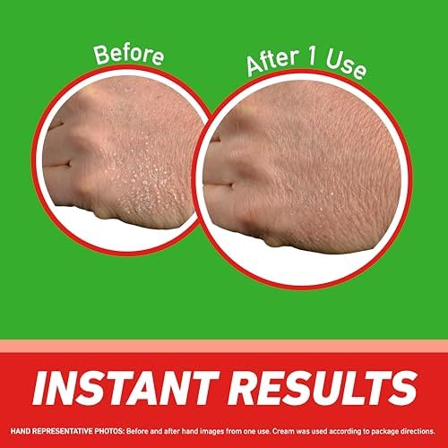 O'Keeffe's Working Hands Pain Relief Cream Skin Protectant with 4% Lidocaine and Cooling Peppermint Oil for Instant Relief from Pain, Itching, Irritation and Dryness, 3oz Tube