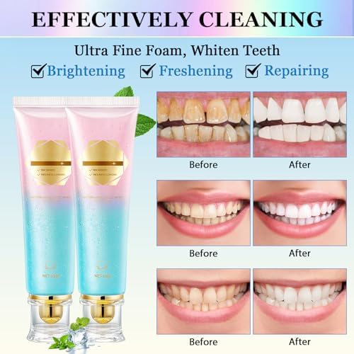 2Pcs Acssart Radiant Whitening Toothpaste, Niacinamide Whitening Toothpastes, Niacinamide Intensive White Toothpastes, Fresh Breath, Deep Cleaning Care