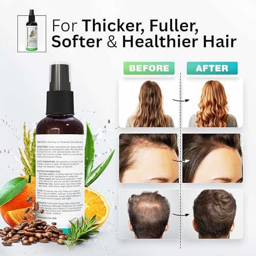NEW Fermented Rice Water Hair Growth Spray with Rosemary, Biotin, Keratin, Caffeine, Vitamins C & B5 - For Thinning Hair, Hairfall, Thicker, Longer, Softer Hair - All Hair Types - Men & Women