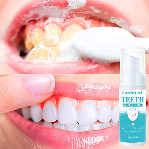 LANTHOME White Foam Teeth Whitening Products (3PCS) Easy to Use Teeth Whitener Foam for White Teeth-Tooth Whitening Mousse