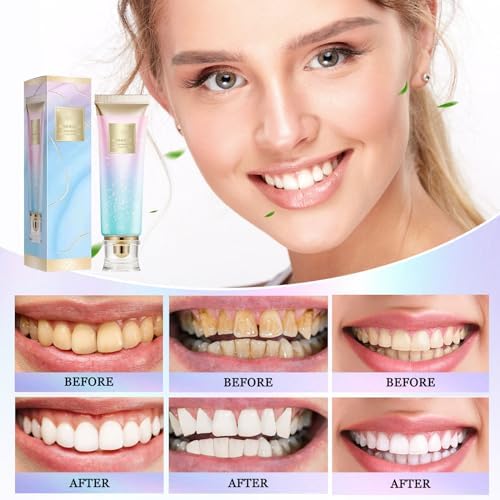 Niacinamide White Toothpaste, Niacinamide Whitening, Complete Care Toothpaste, Remove Tooth Stains, Repair and Protect Teeth, Natural Peppermint