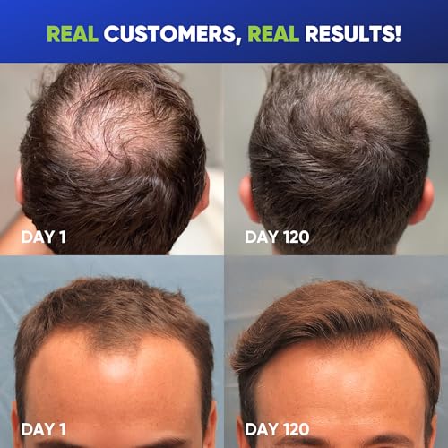 Hair Growth Shampoo for Men - Biotin Thickening Shampoo with Rosemary Tea Tree Oil Caffeine for Hair Loss and Thinning - 13.5 Fl Oz (Pack of 1)