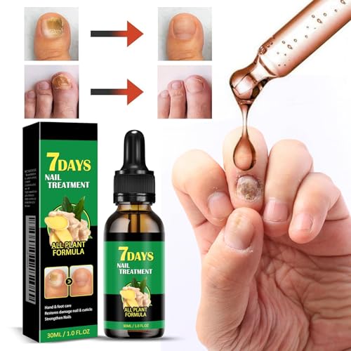 7 days Nail Treatment, Ginger Nail Treatment, 7days nail treatment, Multi-Purpose Nail Repair, Ginger Nail Serum Strengthener Oil Serum Ginger Nail Growth Oil