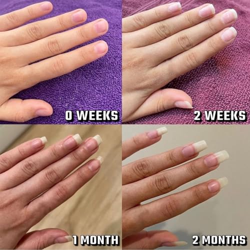 Nailz Nail 𝐆𝐫𝐨𝐰𝐭𝐡 Pen, Radiant Serum Oil Pen, Cuticle Oil for Nails, Nail 𝐍𝐮𝐭𝐫𝐢𝐞𝐧𝐭 Oil Pens for Moisturize Strengthen 𝐁𝐫𝐢𝐠𝐡𝐭𝐞𝐧 Nails Care (4pcs, 2ml)