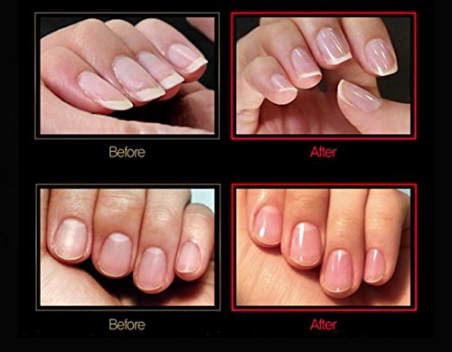 Particular Glass Nail File with Case MiDenso 2nd Generation Double Sided Crystal Beauty Nail Filer Salon Nail Polish Top Christmas Stocking Superior Quality Gift Idea for Men, Women,Lemon Yellow