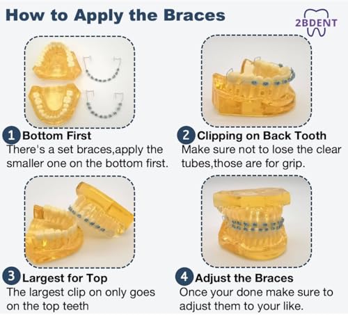 2 Pcs Temporary Tooth Decoration with Metal Wires Bracket Orthodontic Ligature Ties, Fashionable Colorful Fake Braces for Orthodontists Help Patients Understand Their Treatment (Blue)