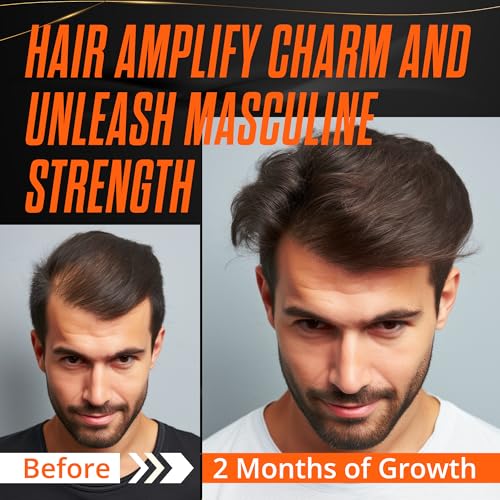 Abera Hair Growth Serum 1.69 fl oz for Hair Loss, Natural Hair Regrowth Treatment for Hair & Beard with Biotin & Castor Oil | Extra Strength & Bigger Size