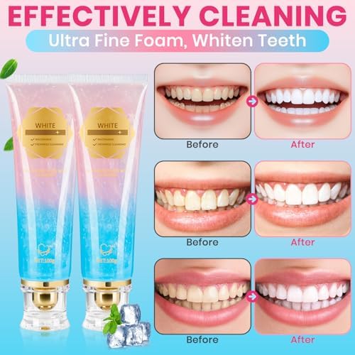 2Pcs Niacinamide Whitening Toothpaste Radiant Whitening Toothpaste, Niacinamide Intensive White Toothpastes, Nicotinamide White Toothpastes, Deep Cleaning Care