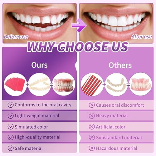at-Home DIY Denture Kit: Full Set of Upper & Lower False Teeth for DIY Smile Transformation-SQ9