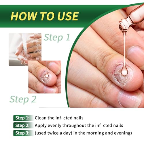 3PCS Ginger Nail Treatment, Ginger Cuticle Care Oil for Nails, Multi-Purpose Nail Repair Nutrient Oil (02)