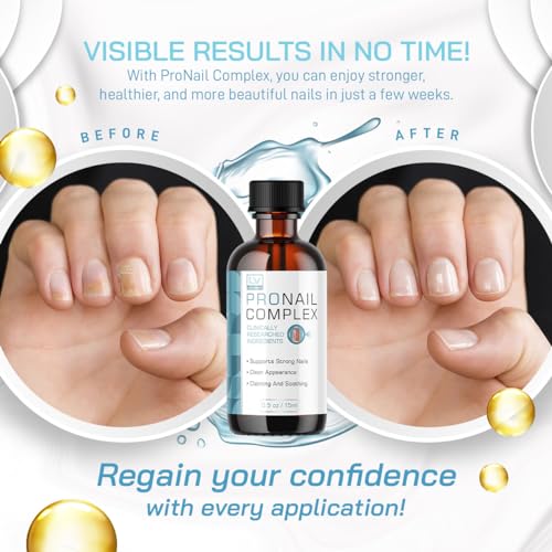 Pronail Complex - Original Formula Toenail Treatment Pronail Complex Liquid Drops Premium Formula Extra Strength, Pro Nail Complex Oil Liquid Drop All Natural Support, 1 Bottle for 1 Month