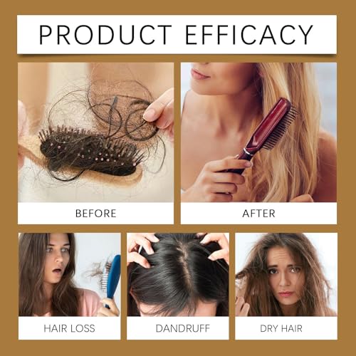 2Pcs Anti-Hair Fall Hair Loss Shampoo, Anti-Hair Fall Promote Hair Growth, Anti Hair Loss Shampoo, Moisturizing & Promoting Hair Growth, Suitable for All Hair Types (2PCS)