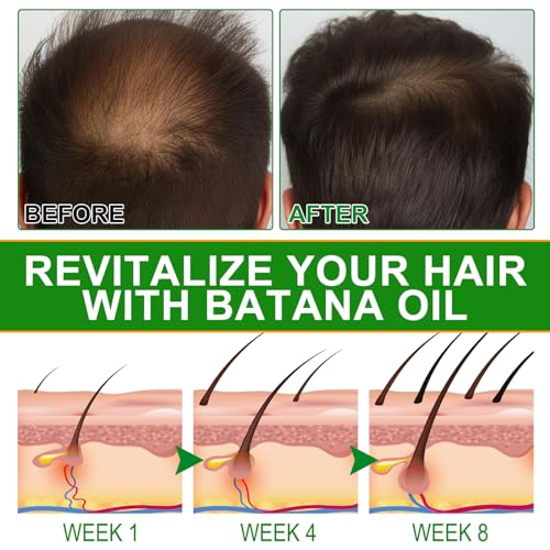 Batana Oil for Hair Growth and Nourishment - Scalp Massager Included, Honduras Pure & Natural Oil for Split Ends Elimination, Enhanced Hair and Skin Radiance, All Hair Types, 2.02 fl oz