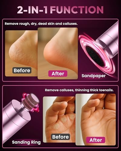 AWROSE Callus Remover for Feet, Cordless Electric Foot Callus Remover with Rechargeable 2600mAh High-Capacity, 6.2IN Aluminum Foot File,Professional Pedicure Tools for Dead/Hard/Dry Skin&Cracked Heels