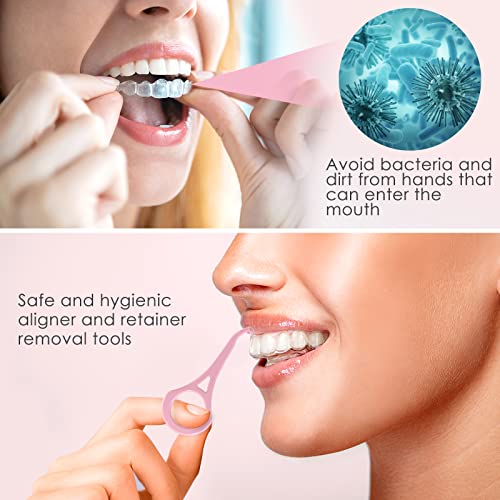 ARGOMAX - Aligner Removal Tool, 100 Retainer Remover Tool, Invisible Braces Removal Tools, Suitable for Removing Braces, Trays, Retainers, Dentures and Aligners(Pink).