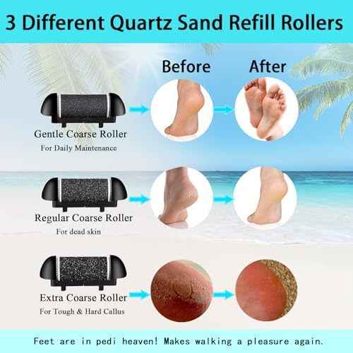 Electric Foot Callus Remover- Long Service Time, Rechargeable Electronic Foot File- Ideal Gift, Professional Pedicure Tools, Waterproof Foot Scrubber, Pedicure Kit Feet Care for Dead Skin (Black)