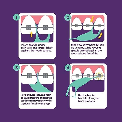 Platypus Orthodontic Flossers for Braces, 40 Count (Pack of 3), Ortho Picks for Adults & Kids, Fits Under Arch Wire, Non-Damaging, Encourage Flossing Habits