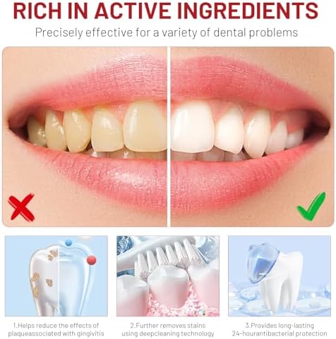 2pcs Sp-8 Probiotics Whitening Toothpaste Upgraded, New Version Fluoride-Free & Probiotic-Infused Formula, Ultra Fresh Mint for Deep Cleaning, Gum Care & Lasting Breath Fresh