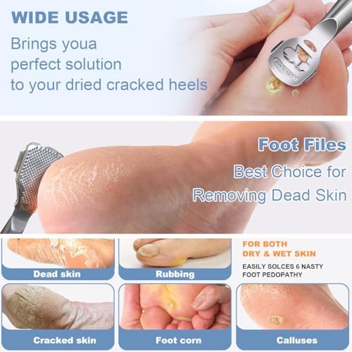 36 Pcs Callus Shaver for Feet Set, (1Stainless Foot File &1 Foot File Heads & 30 Replacement Slices Blades & 4 Pedicure Knife), Professional Callus Remover for Feet Tools for Wet and Dry Feet