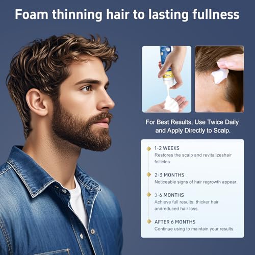 4 Packs Minoxidil Foam, 5% Minoxidil for Men and Women, Infused with Biotin, Hair Growth Treatment, Supports Thicker and Fuller Hair & Beard, Upgraded version (Minoxidil Foam 8.44Oz, 4-Month Supply)