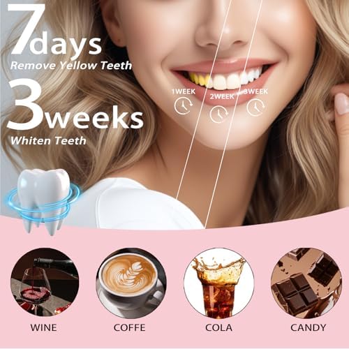 2PCS Niacinamide Whitening Toothpaste-Probiotic Whitening Toothpaste, Intense Triple Whiten, Fluoride-Free, Gentle Mint, Breath Freshening (2pcs)