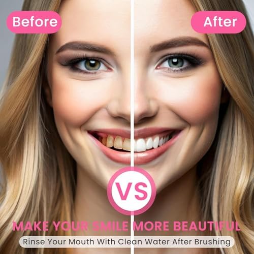 Niacinamide Toothpaste,Niacinamide Intensive Toothpaste,Fresh Breath Toothpastes, Remove Tooth Stains (3.8oz)