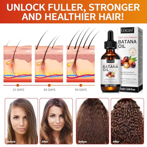 Batana Oil for Hair Growth - 2 Pack, Raw Unrefined Batana Oil,100% Pure Natural Stimulation for Hair Growth, Thickens Strands, Prevent Dry Hair & Hair Loss, 4.04 Oz