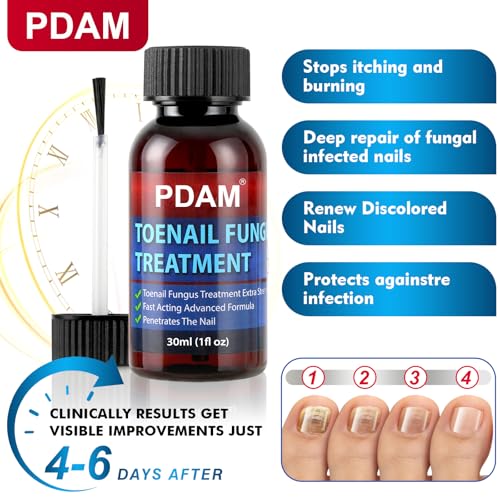 Toenail Fungus Treatment Extra Strength - Toe Nail Fungus Treatments for Thick, Nail Strengthener and Growth, Nail Fungus Treatment Extra Strength for Broken, Discolored Nail & Ingrown Toenail - 30ml