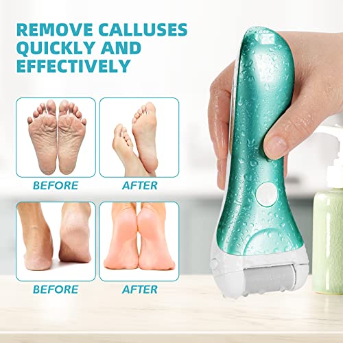 Callus Remover for Feet, Nicebirdie Electric Foot File Callus Removers Rechargeable Waterproof Pedicure Tools Foot Scrubber Shaver Feet Care Tool for Cracked Heels Dead Skin （Green）