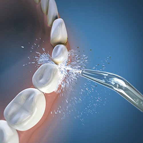 Waterpik Whitening Water Flosser Replacement Tip, Classic Jet, White and Black, 2 Count