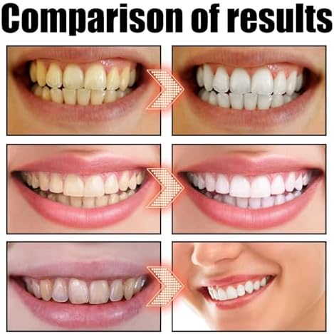 Coconut Oil Pulling for Teeth Whitening-Cocofresha Powerful Organic Coconut Peppermint Pulling Oil for Teeth and Gums, Pure Mouthwash Mint Freshness, Natural Cleanse, 4 Oz (2)