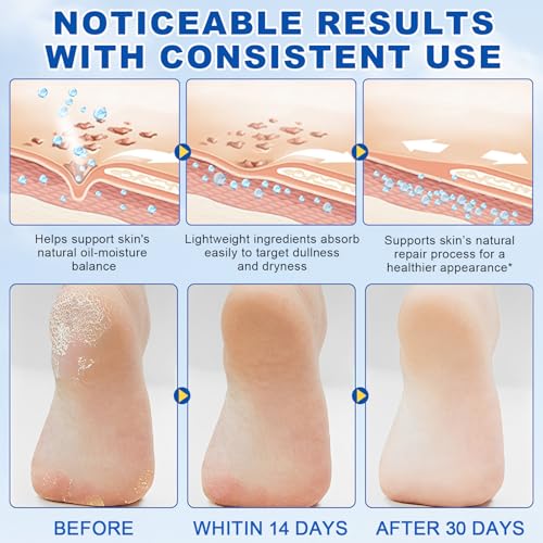 2Pack 60% Urea with 2% Salicylic Acid Urea Foot Care Stick, Foot Cream Moisturizer for Dry Cracked Feet, Knees, Elbows, Hands,Moisturizes and Hydrates the Dry Skin,Callus Remover & Skin Softener