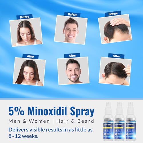 5% Minoxidil Spray 3PCS, Minoxidil for Men Hair and Beard, Minoxidil for Women Hair Growth, Minoxidil for Men Hair Growth.