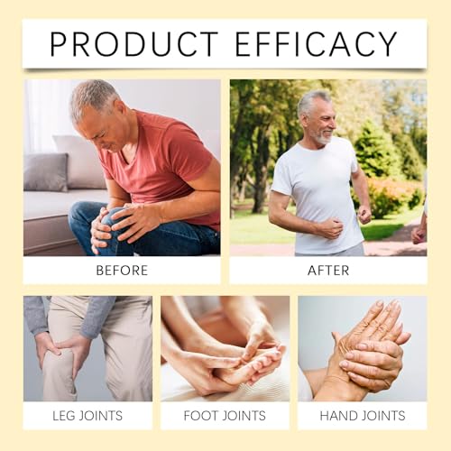 Bee Venom Joint Gel, Professional Bee Venom Ointment,Bee Venom Cream,Bee Venom Joint and Bone Cream for Back, Knee, Hands, Neck, Feet -60g (2PCS)