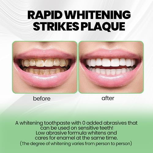 Nano-Hydroxyapatite Toothpaste – 10%-Hydroxyapatite -Appropriate for Sensitive Teeth, Whitening | Fluoride-Free, Mint Flavor, for Adult, Kids Oral Care