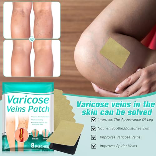 LegRenew Varicose Veins Patch,Professional Relief for Varicose Veins in The Legs，Natural Improvement Spider Veins Patch（2PCS)