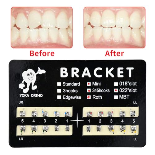 60Pcs Tooth Brace Teeth Model Mini Roth Brackets Roth 022 Slot Bondable with Hook on 347 (60pcs-Black)